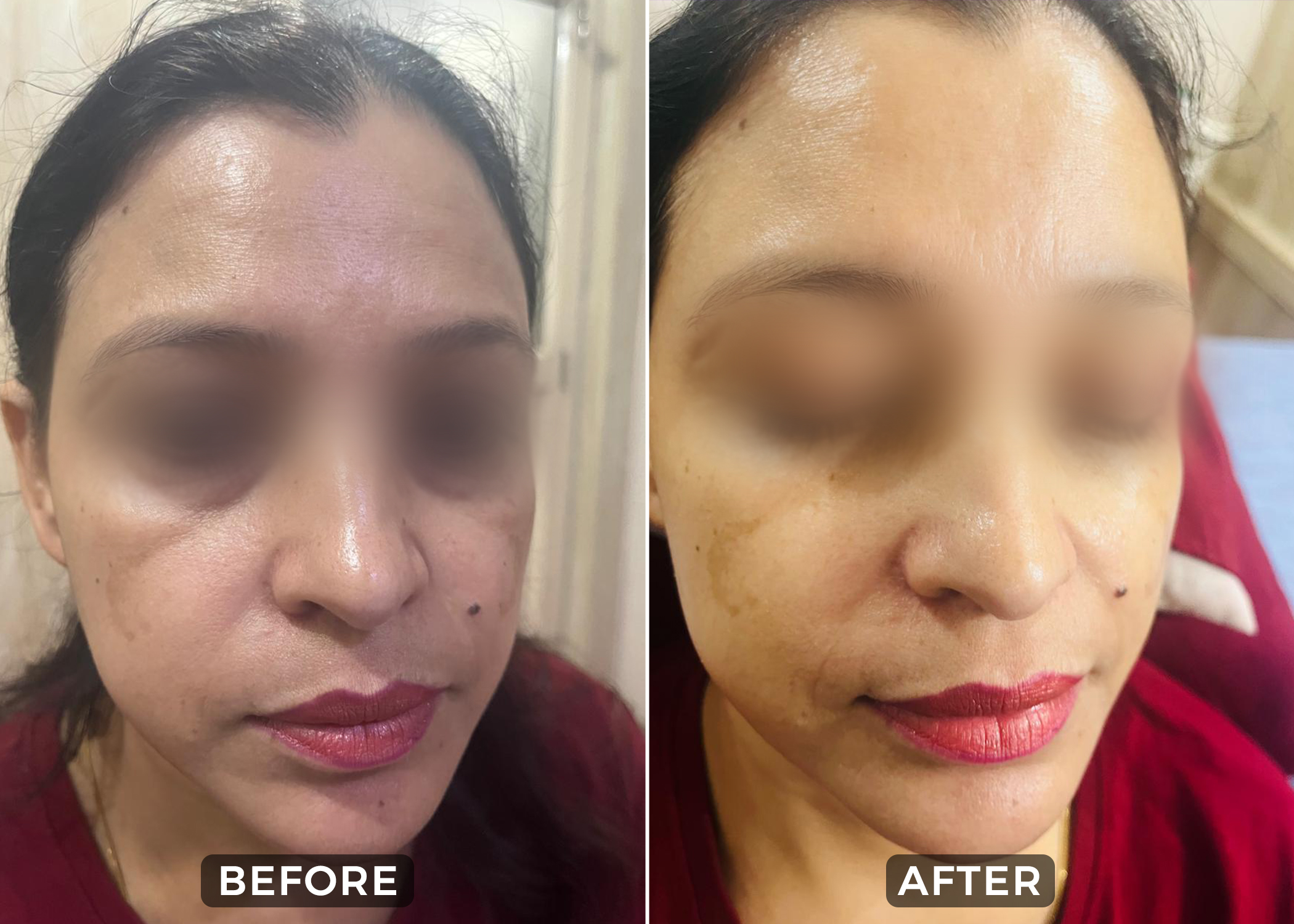 Before & After 1