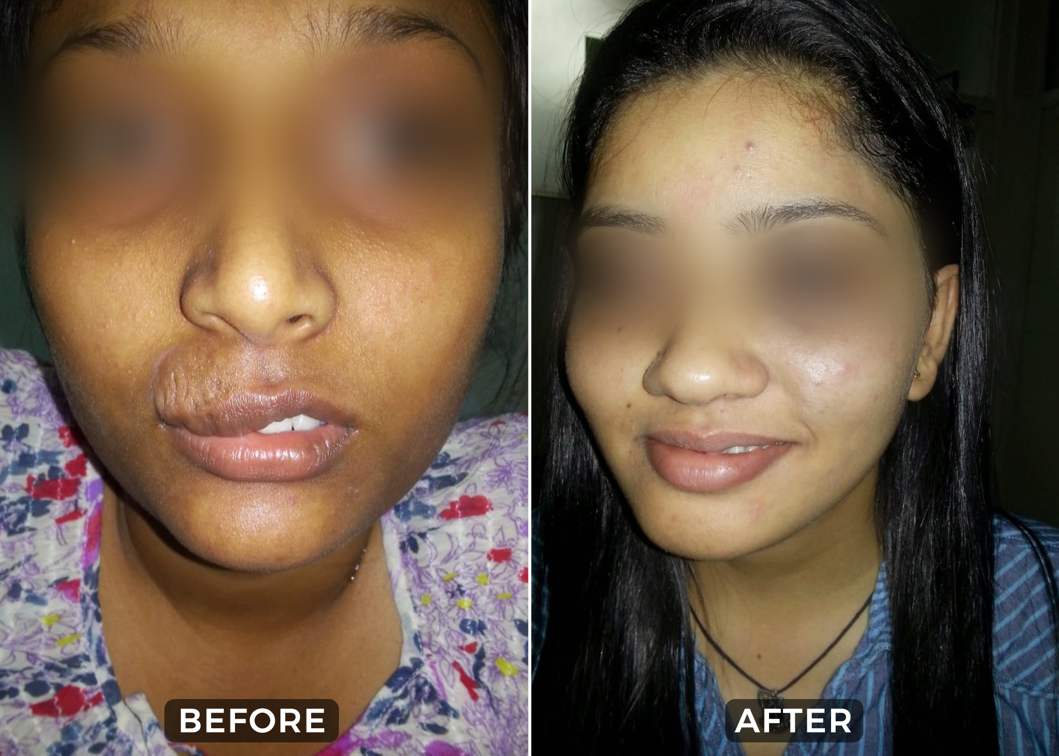 Before & After 2