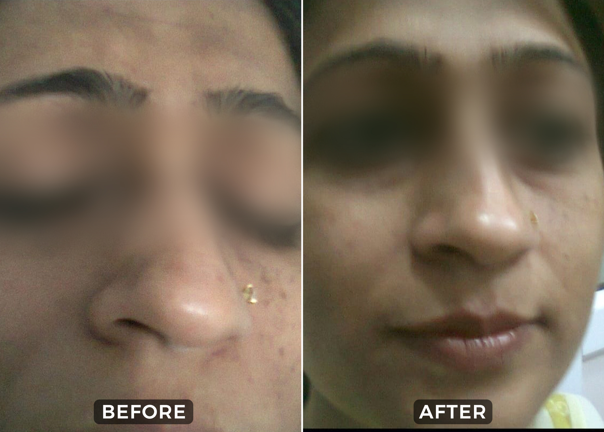 Before & After 3