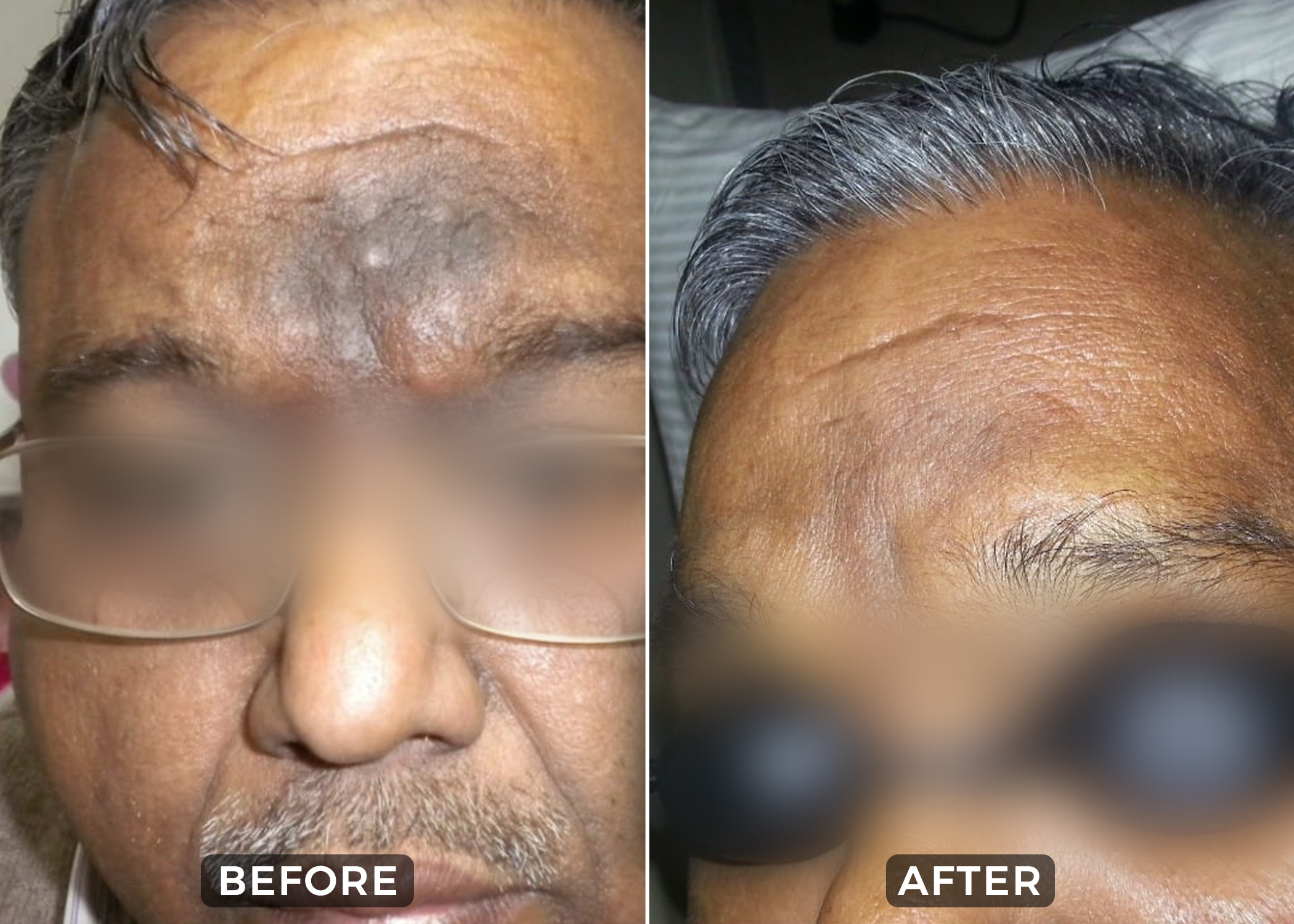 Before & After 1