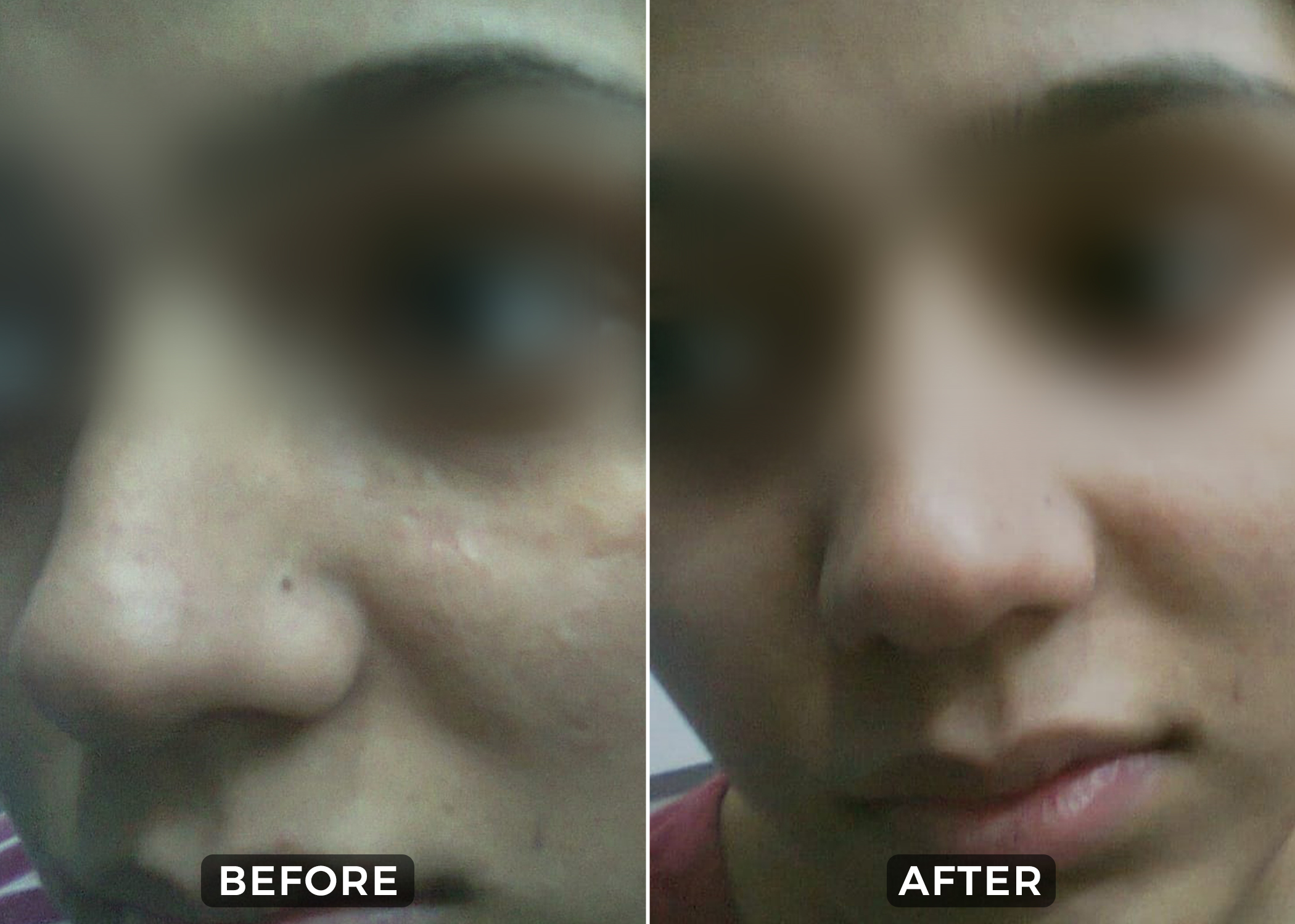 Before & After 2