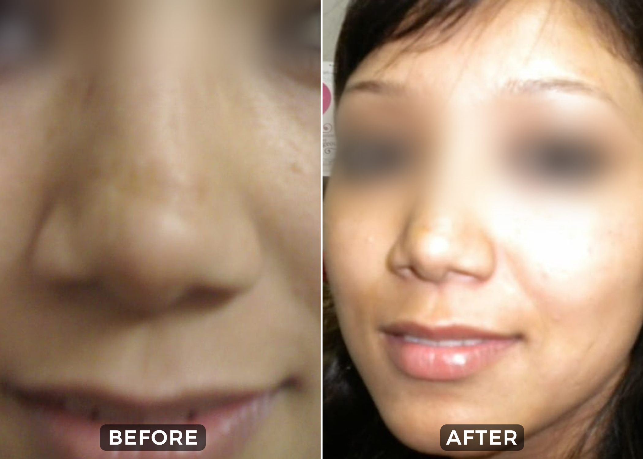 Before & After 3